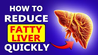 I Cured My Fatty Liver in 30 Days and You Can Too [upl. by Saint]