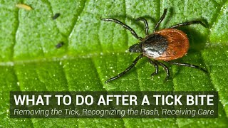 What to Do After a Tick Bite  Johns Hopkins Lyme Disease Research Center [upl. by Amilah]