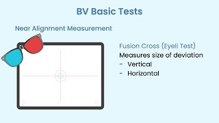 Basic Binocular Vision Assessment [upl. by Ttegdirb253]