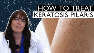 How to Effectively Treat and Remove Chicken Skin Keratosis Pilaris [upl. by Zohara695]