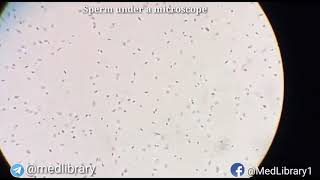 Espermatozoides observados con el microscopio optico [upl. by Ellatsirhc212]