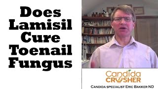 Does Lamisil Cure Toenail Fungus  Ask Eric Bakker [upl. by Atiroc]