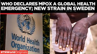 WHO Declares Global Health Emergency Over New Mpox Strain Clade Ib  Times Now World [upl. by Levy386]