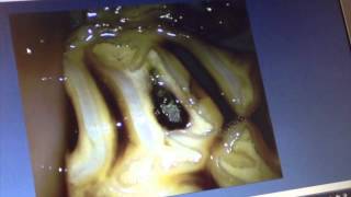 Oroscopic examination of the molar arcades teeth in a horse occlusal surface [upl. by Fenny]