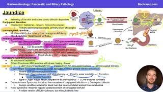 Jaundice amp Hyperbilirubinaemias for Step 1  Gastroenterology  Med School Bootcamp [upl. by Arita875]