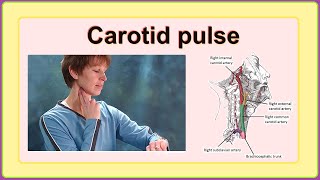 carotid pulse [upl. by Enimzaj]