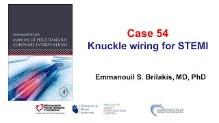 Case 54 PCI Manual  Knuckle wiring for STEMI [upl. by Siraf]