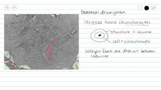 Fibrocartilage Fibrous cartilage Connective Tissue [upl. by Gracie]