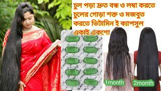 চুল পড়া বন্ধ ও লম্বা করতে ভিটামিন ই ক্যাপসুলের ব্যবহার । vitamin e capsule এর উপকারীতা । vitamin e [upl. by Lugar]