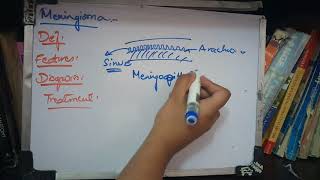 MENINGIOMA in relation to orbit made simple [upl. by Lazes]