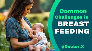 Common Challenges in Breastfeeding Overcoming Hurdles for New Moms [upl. by Rheta383]