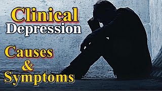 Clinical depression  signs of depression  depression symptoms [upl. by Geof747]