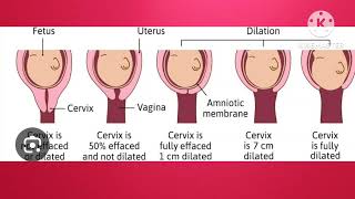 cervical effacement dilatation showuterine contraction  lectureenglishmedical education [upl. by Shyamal]