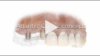 Atlantis Conus concept [upl. by Gottwald]