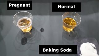 Baking Soda Pregnancy Test  A 2000yearold ancient test [upl. by Loren]