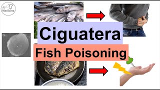 Ciguatera Fish Poisoning Ciguatoxin  Symptoms Numb Feet Diarrhea Diagnosis Treatment [upl. by Hertz]