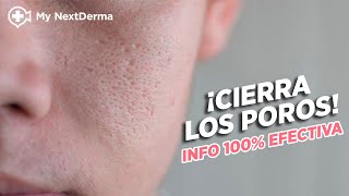 ¡CIERRA LOS POROS Info 100 Efectiva  Dermatólogo Responde [upl. by Rosenthal924]