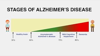 Diagnosing Alzheimer’s Disease [upl. by Gnilrets]