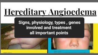 Hereditary Angioedema [upl. by Odin473]