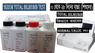 Bilirubin Test Procedure কিভাবে ০ থেকে ২৮ দিনের বাচ্চাদের Total Bilirubin Test করবেন [upl. by Gessner]