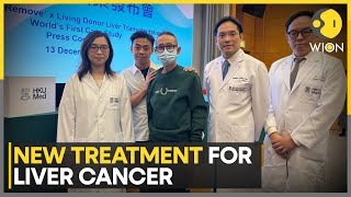 Hong Kong Researchers claim worlds first with liver cancer treatment  Latest News  WION [upl. by Anthony]