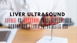 Liver Ultrasound Normal vs Abnormal Image Appearances Comparison  Liver Pathologies USG [upl. by Cecilia]