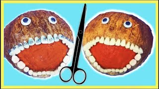 Emergency FruitSurgery Trans Flag Colored Braces on a Coconut DiscountDentist  Ep 58 Shorts [upl. by Philcox718]