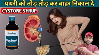 Cystone syrup use dose benefits and side effects full review in hindi [upl. by Jack284]