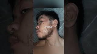 Kirkland Minoxidil Beard Journey 18 WEEK TRANSFORMATION [upl. by Jena]