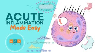 Acute Inflammation Made Easy [upl. by Mccourt]