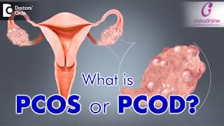 What is PCOS or PCOD  Dr Bandita Sinha of Cloudnine Hospitals  Doctors Circle [upl. by Lucias]