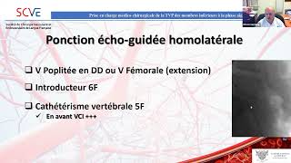 Prise en charge médicochirurgicale de la thrombose veineuse profonde des membres inférieur [upl. by Ecinahs449]