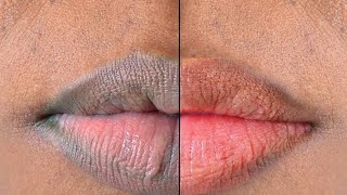 Get Baby Soft Pink Lips Naturally at Home [upl. by Brana]