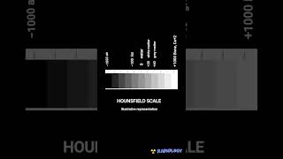 Hounsfield scale CT radiology [upl. by Ettelrahc174]