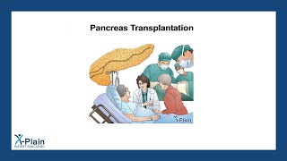 Pancreas Transplantation [upl. by Phi]