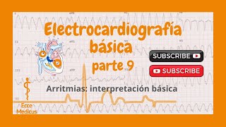 Electrocardiografía básica 9  Arritmias interpretación [upl. by Adnorahs239]