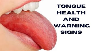 Tongue Healthquot and quotWarning Signs [upl. by Cruickshank]