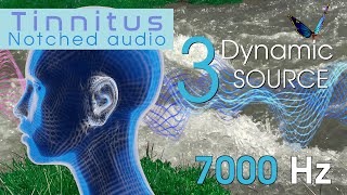 Tinnitus Sound Therapy Natural 7000 Hz Notched Audio with 3 Dynamic Sound Sources [upl. by Langston124]