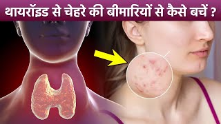 Thyroid Side Effects On Skin Reason amp Treatment  Thyroid Effects On Skin Care Tips  Boldsky [upl. by Karlyn]