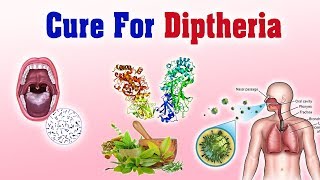 Diphtheria गलघोटू  Ayurvedic Treatment  Symptoms and Causes [upl. by Hannah339]