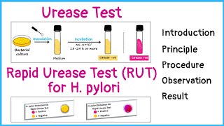 Urease test for identification of bacteria  Rapid urease test for H pylori  Principle  Procedure [upl. by Aninaig]