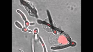 Neutrophils wrestling with hyphae hires [upl. by Eivod418]