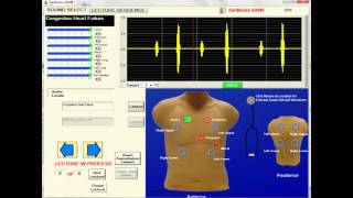 SAM II Tutorial Video [upl. by Tice]