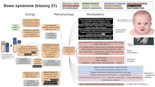 Down syndrome trisomy 21 mechanism of disease [upl. by Ihtac829]