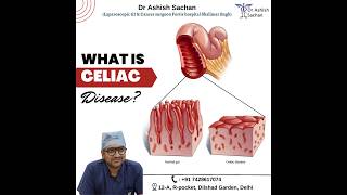 Symptoms of Celiac disease DrAshishSachan [upl. by Huberto]