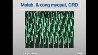 Myopathy Lecture  Routine [upl. by Sheelagh450]