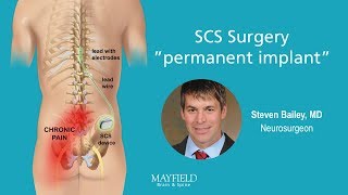 HF10 Spinal Cord Stimulation Part 2 Surgery [upl. by Kentiga]