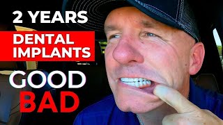 The GOOD and BAD Of My Dental Implants After 2 Years [upl. by Tommy]