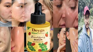 Deyga Beautifying Serum  Honest Review [upl. by Fraser66]