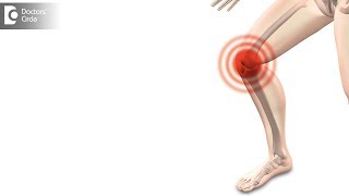 How long does it take to recover from Arthroscopic Knee Surgery  Dr Bala Murali Krishnan [upl. by Norda]